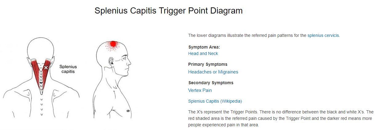 splenius capitis trigger point referral splenius capitis trigger point referral